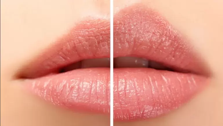 Elazığ Dudak Vitamini