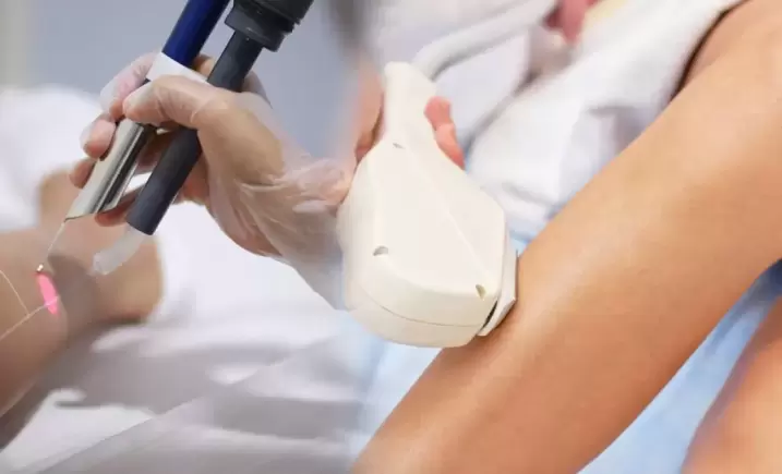 Elazığ Lazer Epilasyon